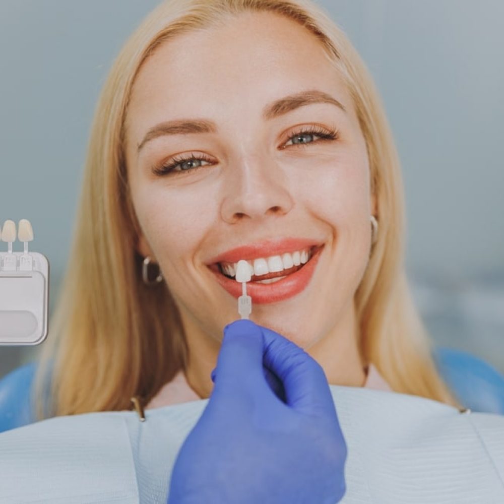 Dental Veneers in Eaton