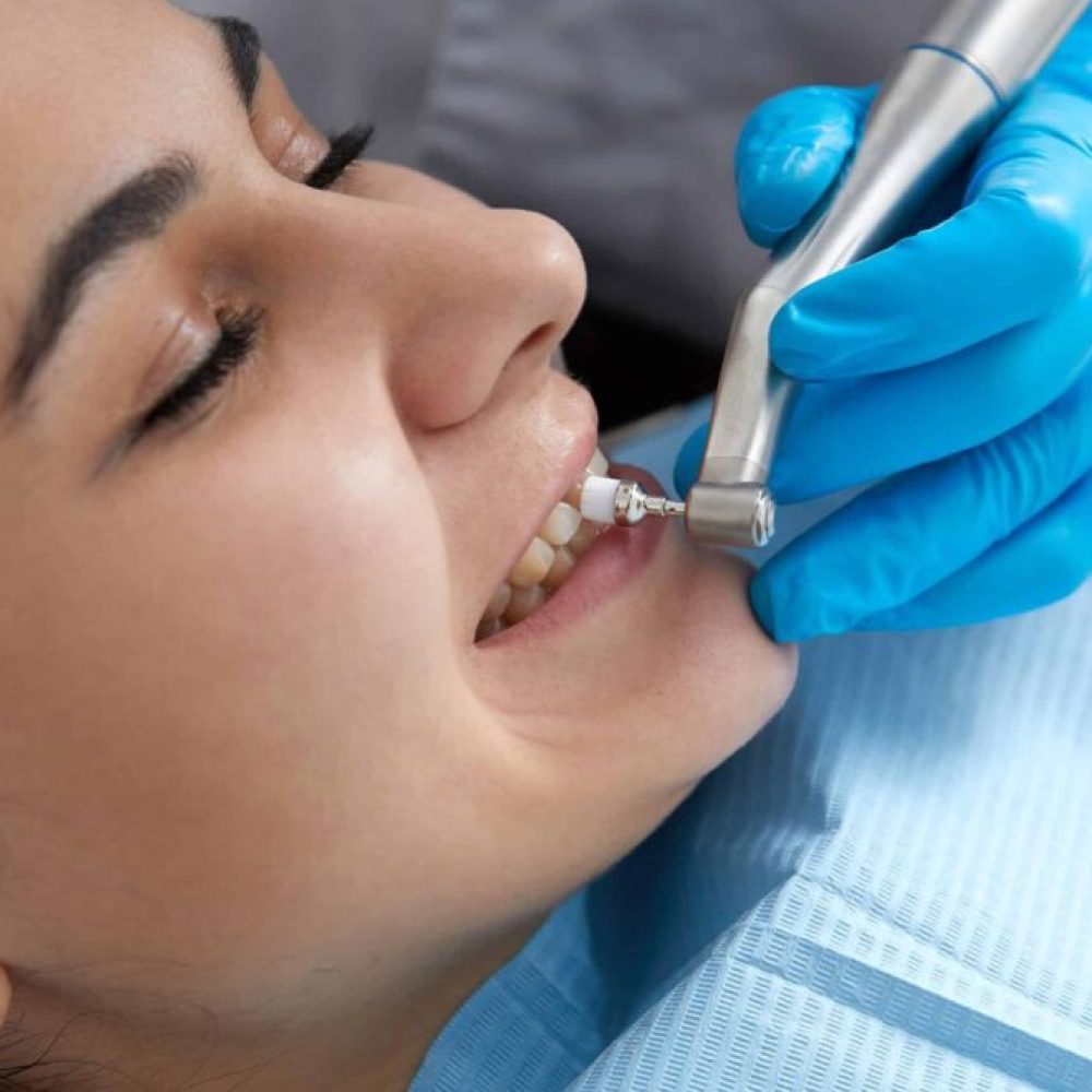 Dental Cleanings Eaton